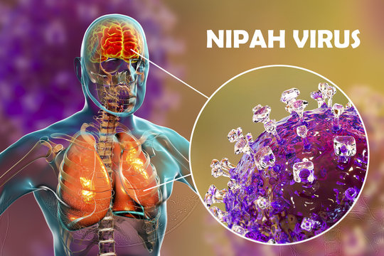 Illustration showing Nipah virus particles and neurological involvement